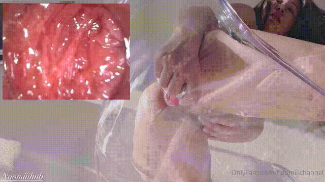 ❤️❤️❤️萬人追蹤極品蜜桃臀女神戶外溫泉水戰,內窺鏡看屁眼在肛交